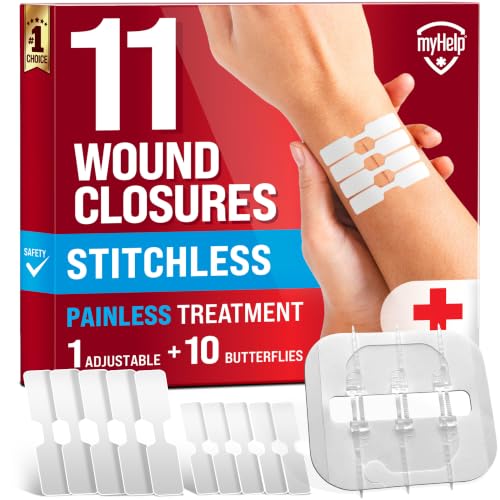 tiras de cierre de heridas sin dolor