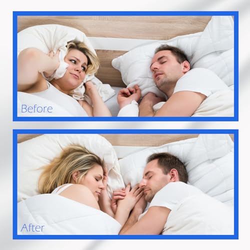 tiras nasales para una mejor calidad de sueño