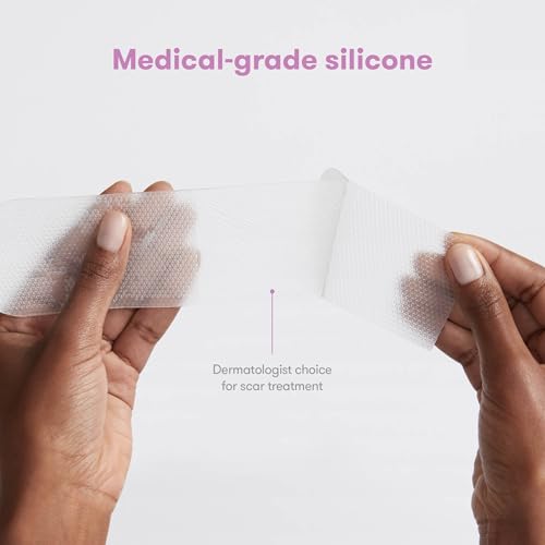 Tratamiento efectivo para cicatrices keloides