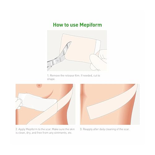 Venda Mepiform para recuperación rápida